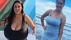 Po zmenení ader si ena uívá normální ivot, o kterém si jet ped pár lety...