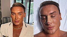 Pes sto invazivních zákrok v oblieji má za sebou mu posedlý vlastním...