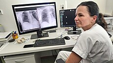 Primáka RDG oddlení Nemocnice AGEL ternberk MUDr. Jindika Judasová...