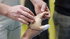 Osmatřicetiletého muže zasáhl elektrický proud, lékaři v Brně mu zachránili...