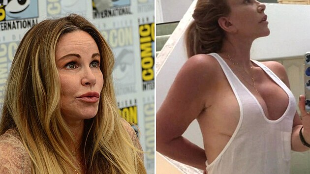 Implant�ty m�la m�t here�ka za odm�nu. Po letech s men��m poprs�m cht�la b�t stejn� p�ita�liv� jako jej� vnadn�j�� hollywoodsk� kolegyn�. Bohu�el ale v�e nedopadlo tak, jak m�lo.