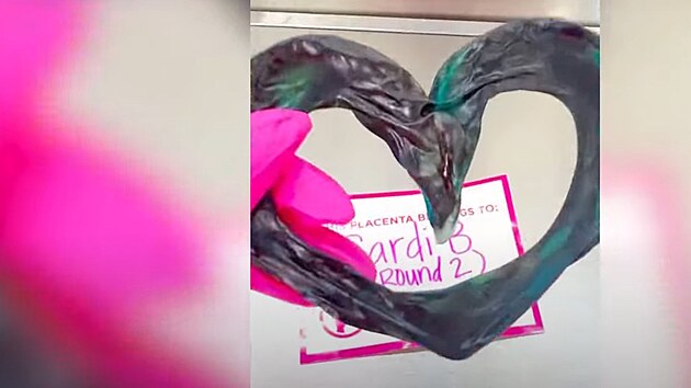 Pupe�n�k vytvarovala tv�rkyn� pro Cardi B do tvaru srdce, vznikl z n�j zlat� p��v�sek. (listopad 2025)