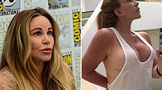 Implantáty mla mít hereka za odmnu. Po letech s mením poprsím chtla být...