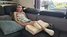 Po otrav� krve musela Monika podstoupit amputaci obou dolních kon�etin. Nyní se...