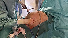 Tomá Paseka, pedseda herniologické sekce eské chirurgické spolenosti a...