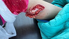 Zran�né dít� na závodi�ti v CHKO.