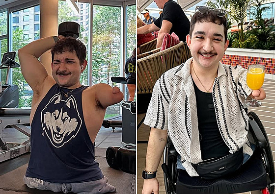 Mu� nemá ruce, ale sám �íká, �e si hendikepovaný nep�ipadá. Rád lidem opakuje,...