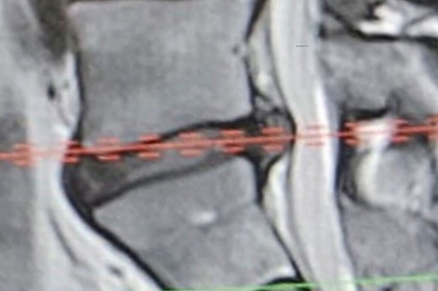 Snad to prezident pochopí a dá mi ještě příležitost, vzkázal Turek z nemocnice