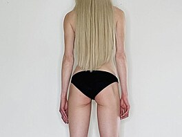 Theresia Fischerová