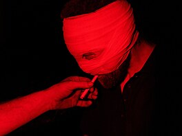 Ukrajinský voják Artem z praporu Vlci Da Vinci, který utrp�l zran�ní b�hem boj�...