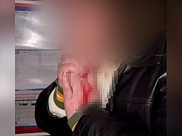 Krvavé zran�ní krku si z napadení odnesl mu� v Jen�tejn�