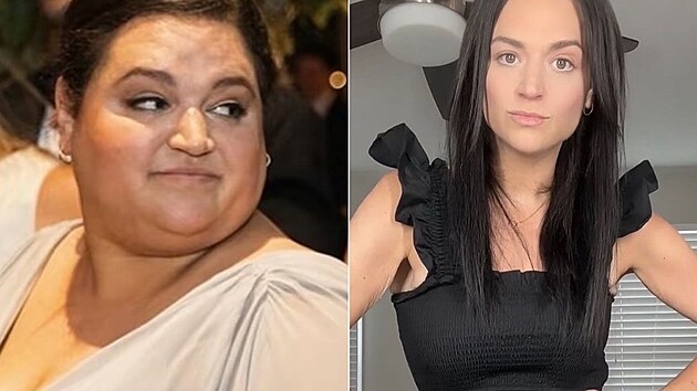 Shodila des�tky kilo, ale k dokonalosti j� to nesta�ilo. M�la toti� na t�le spoustu p�ebyte�n� k��e, kter� bylo pot�eba se zbavit. S t�m pak pomohla plastick� operace.