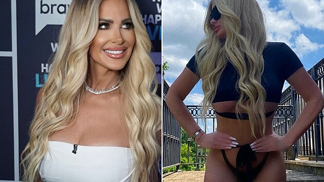 Kim p�iznala, kolik plastik u� za sebou m�. �okovala t�m p�edev��m sv� p��tele, kte�� o tom nem�li tu�en�.