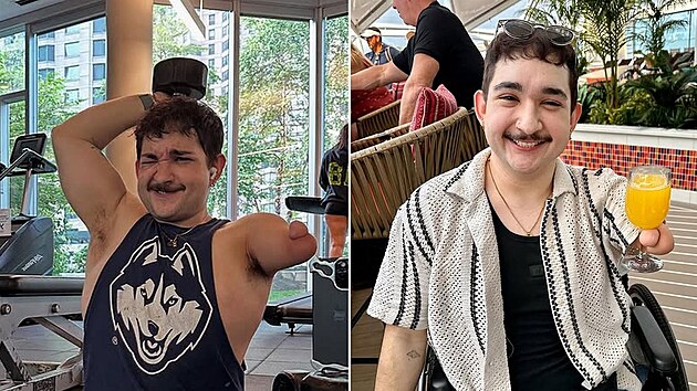 Mu� nem� ruce, ale s�m ��k�, �e si hendikepovan� nep�ipad�. R�d lidem opakuje, �e je ��astn� a nic mu nesch�z�. �Alespo� u�et��m za boty a kalhoty,� podot�k� s �sm�vem.