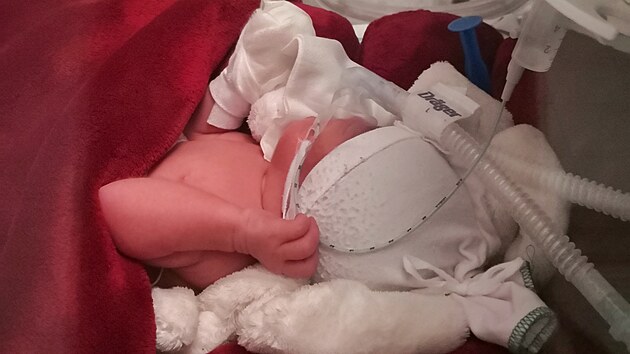 Lillinka str�vila v nemocnici 20 dn�. 