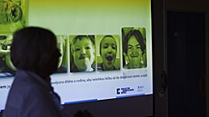 Specializované centrum ve Fakultní nemocnici Brno se v�nuje lé�b� roz�t�pu....