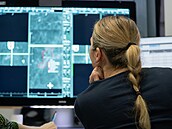 Stop vypalování: Dnení léka pijímá obrazová data pacient digitáln