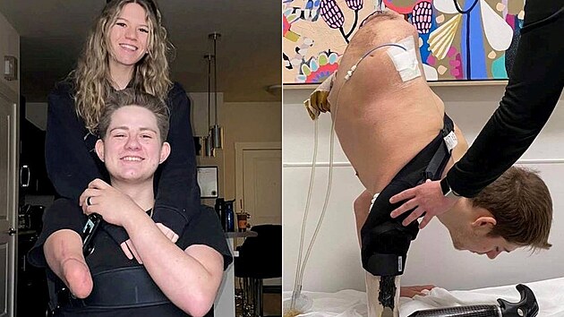 Po hroziv� nehod� mu l�ka�i d�vali minim�ln� �ance na p�e�it�. P�esto je st�le �iv�. V�ichni to pova�uj� za z�zrak.