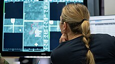 Stop vypalování: Dnení léka pijímá obrazová data pacient digitáln