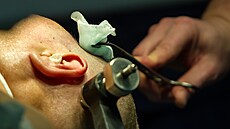 P�íprava na trepanaci lebky