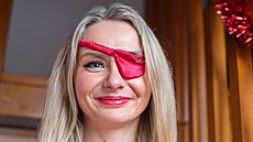 Koleta Hofman z Nové Vísky u Kadan�. Po pádu z hotelové terasy málem zem�ela....