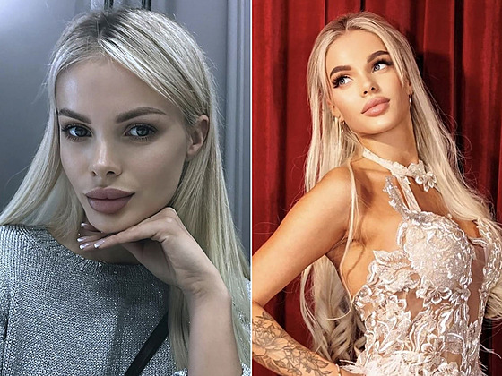 Modelka má za sebou zá�itek, který by nikomu nep�ála.