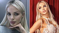 Modelka má za sebou zá�itek, který by nikomu nep�ála.