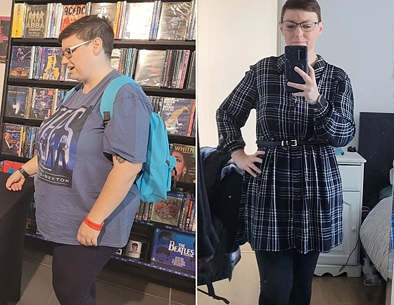 �ena po operaci zhubla celkem jednat�icet kilogram�.