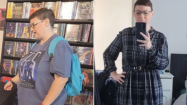 �ena po operaci zhubla celkem jednat�icet kilogram�.