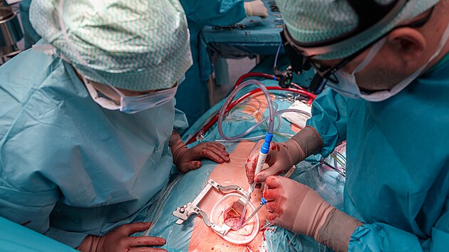 Pro pacienty tento zp�sob operace znamen� �etrn�j�� pr�b�h cel�ho z�kroku a p�edev��m men�� poopera�n� bolesti, rychlej�� zotaven� i n�vrat k b�n�mu fungov�n�.