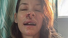Evangeline Lilly ukázala fanou�k�m foto po pádu na plá�i, p�i kterém utrp�la...