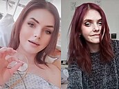 Shining Ája sdílela na TikToku sv�j boj s mentální anorexií i kardiologickým...