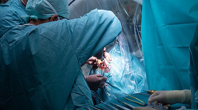 Ve Fakultn� nemocnici Olomouc provedli l�ka�i unik�tn� operaci pacienta trp�c�ho obsedantn�-kompluzivn� poruchou.