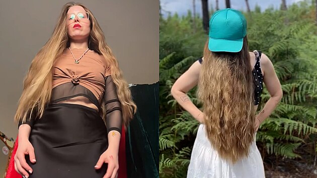 Hv�zda Harryho Pottera si nechá ud�lat nová prsa