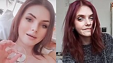 Shining Ája sdílela na TikToku sv�j boj s mentální anorexií i kardiologickým...