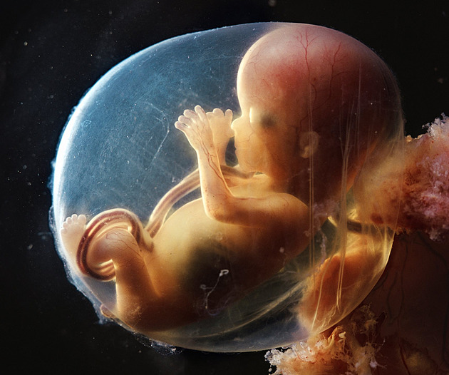 Nafotil zázrak lidského stvoření. Převratné snímky zneužili odpůrci potratů