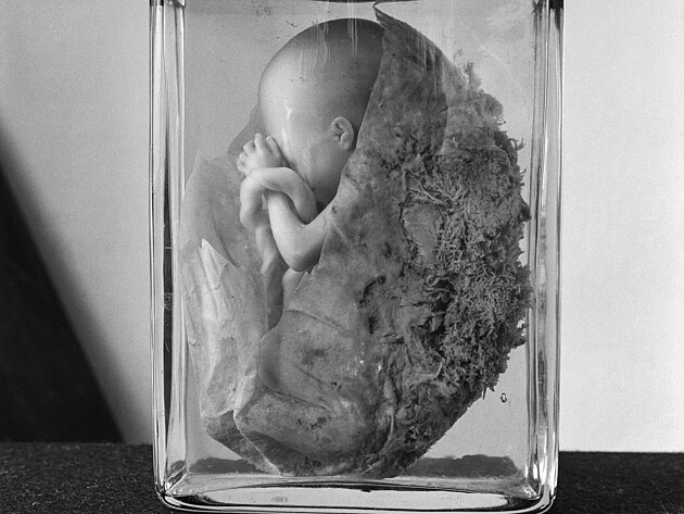 Plod ve formal�nu na fotografii Lennarta Nilssona z roku 1952