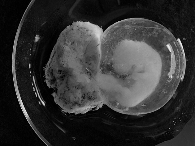 Embryo ve formal�nu na fotografii Lennarta Nilssona z roku 1952