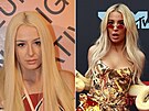Influencerka Tana Mongeau si nechala zv�t�it p�edev�ím horní ret, proto�e...