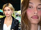 Man�elka Justina Biebera modelka Hailey Bieberová si nechala v oblasti obli�eje...