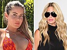 Prominentka Brielle Biermannová má výrazn� zv�t�ené rty. Krom� toho i jiný tvar...