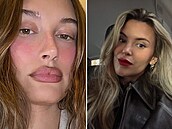 Kdy� se slavné �eny rozhodnou pro zm�nu tvaru rt�.