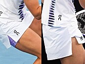 Úvodní kolo Australian Open p�ineslo pro Igu �wiatekovou ne�ekanou komplikaci....