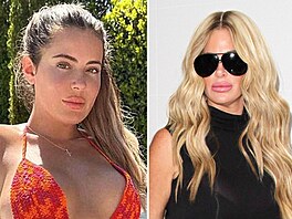 Prominentka Brielle Biermannová má výrazn� zv�t�ené rty. Krom� toho i jiný tvar...