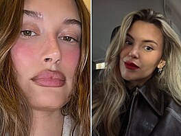 Kdy� se slavné �eny rozhodnou pro zm�nu tvaru rt�.