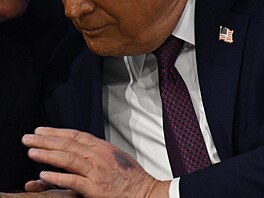 Mod�ina na ruce Donalda Trumpa. (22. ledna 2026)