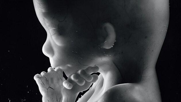 Lennart Nilsson: Zrozen� d�t�te