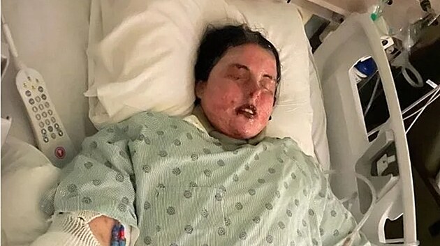 Emily McAlisterov�