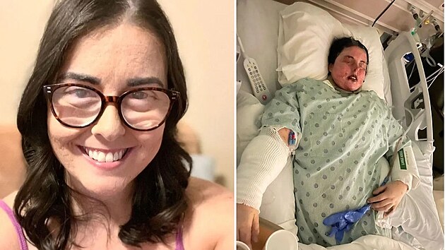 Extr�mn� stav �eny byl �ivot ohro�uj�c�.