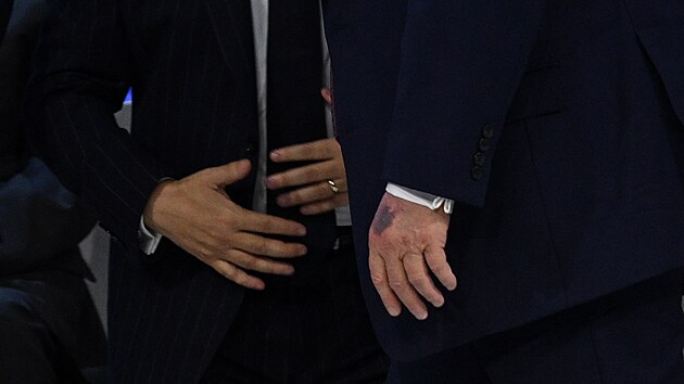 Donaldu Trumpovi se v Davosu op�t objevila na ruce mod�ina. (22. ledna 2026)